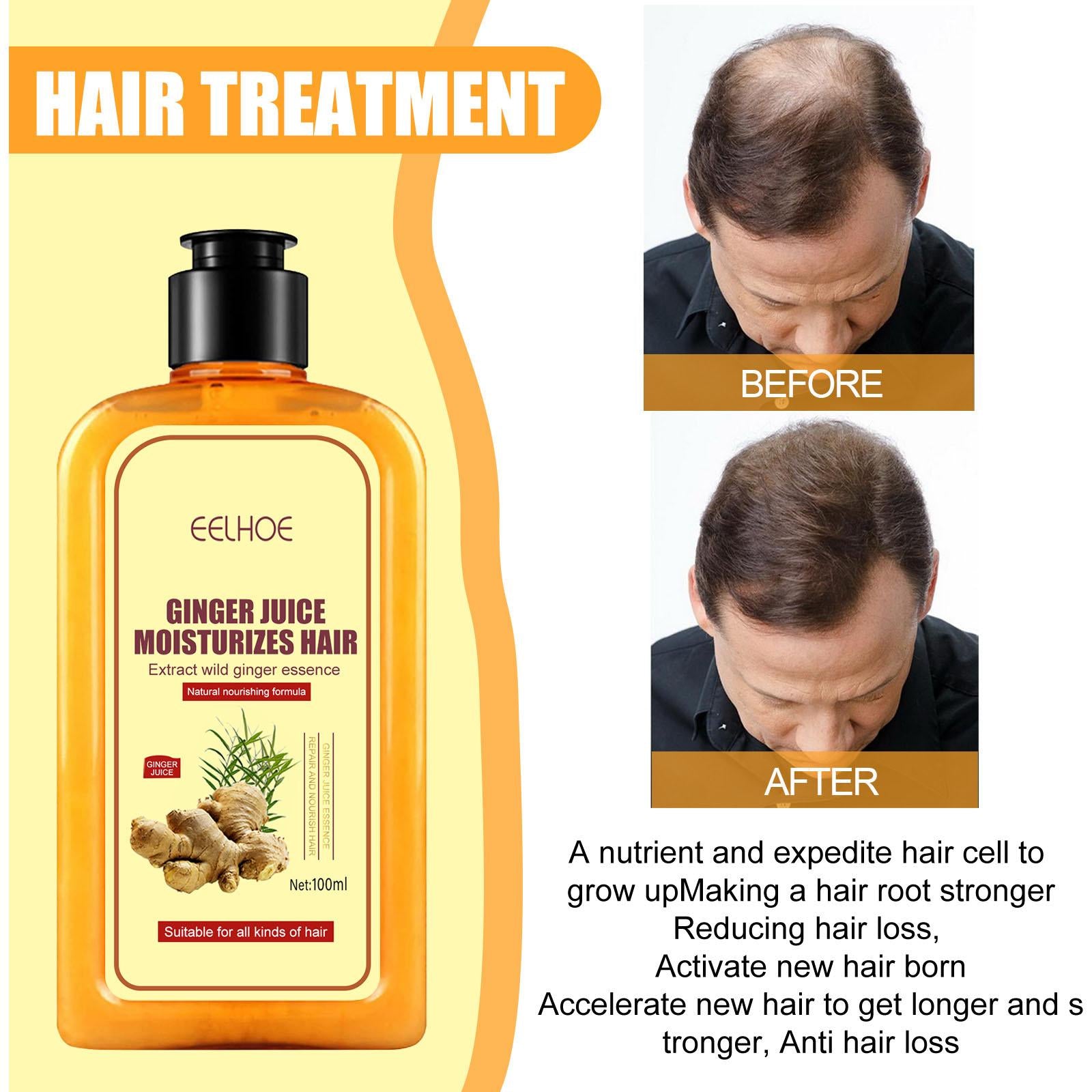Ginger Instant Hair Regrowth Shampoo