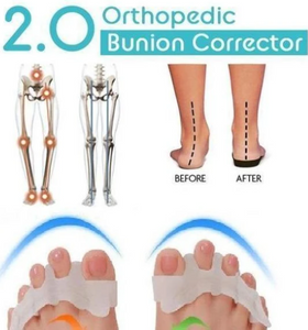 Orthopedic Bunion Corrector (1 Pair)